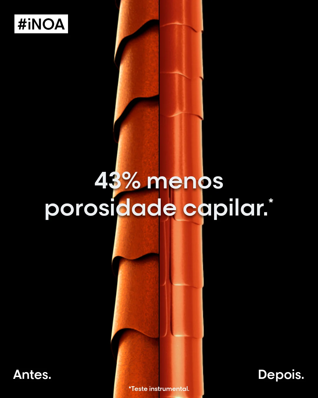 43% menos porosidade capilar