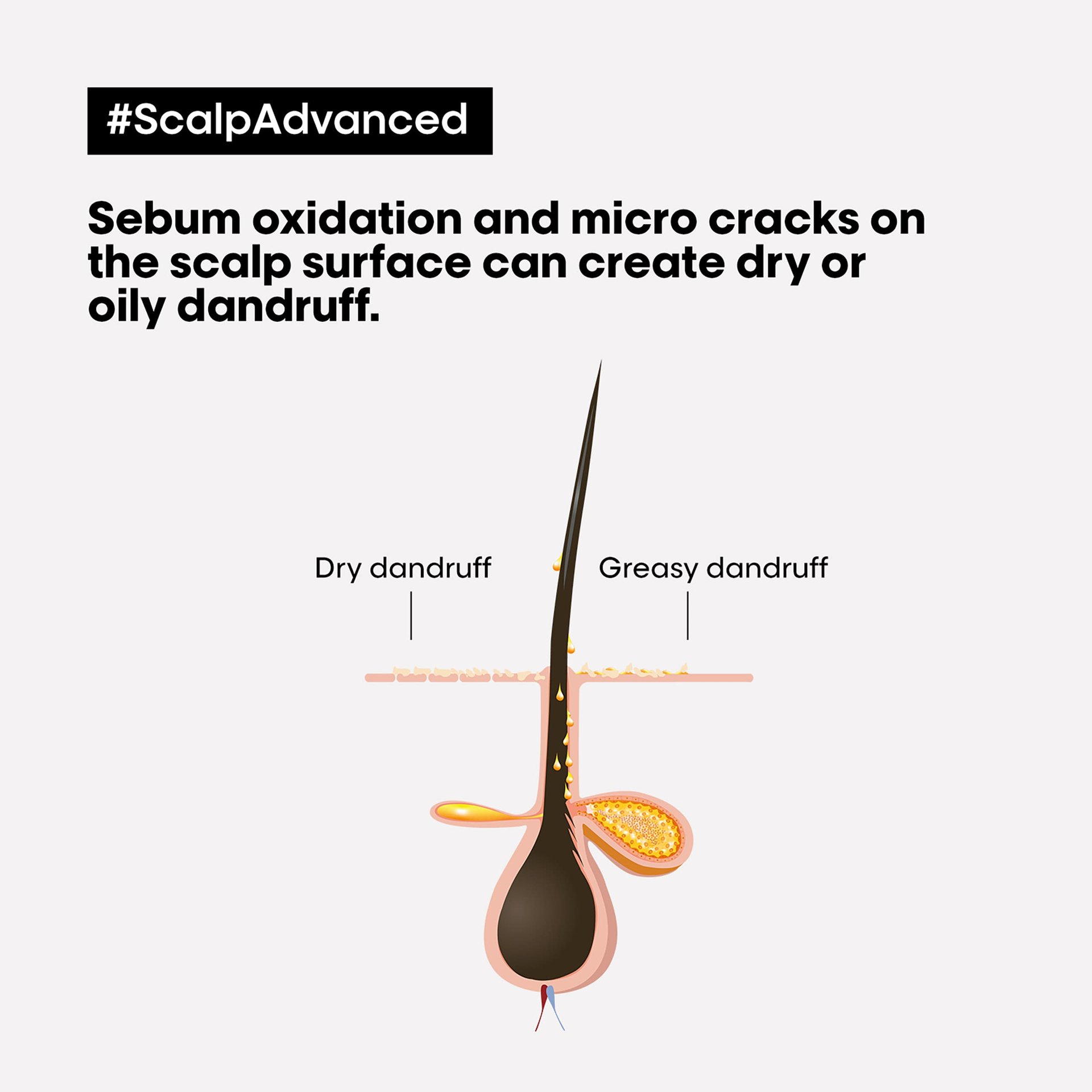 scalp-advanced-anti-oiliness-2-in-1-deep-purifier-clay7