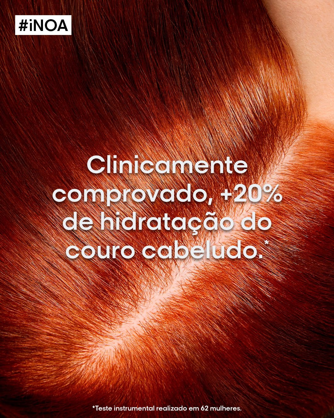 Imagem Clinicamente comprovado, +20% de hidratação do couro cabeludo.