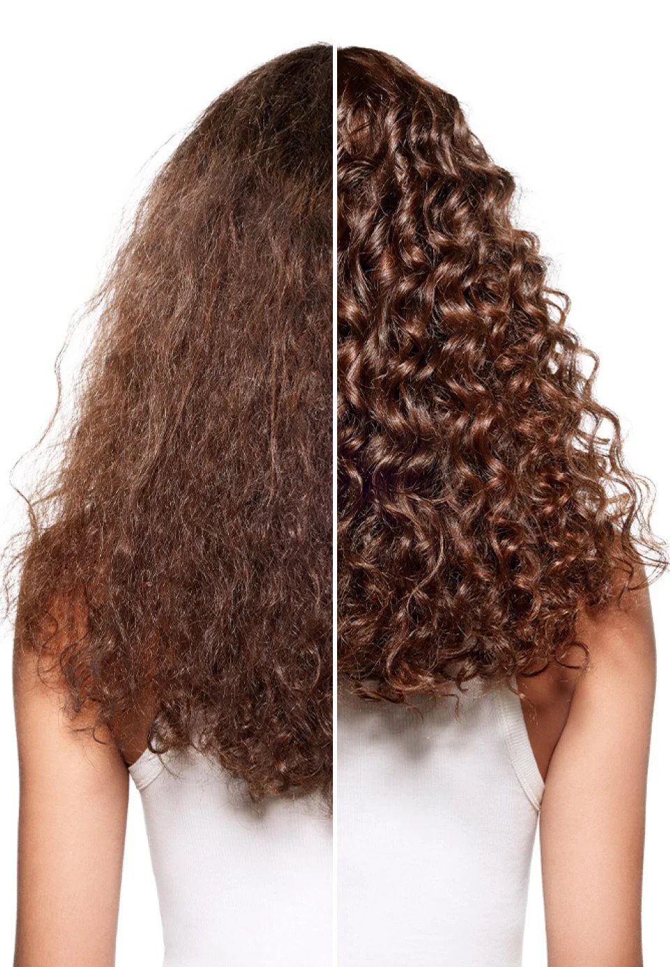 Saúde do couro cabeludo e queda de cabelo